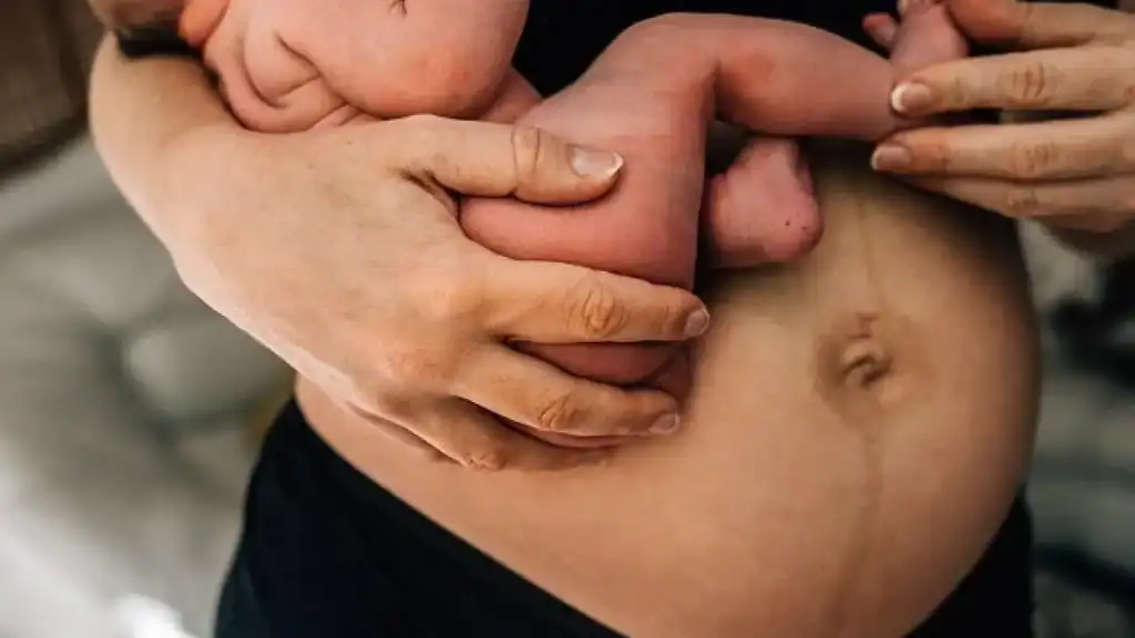 Why Is My Stomach Still Big After Pregnancy Cheadle?